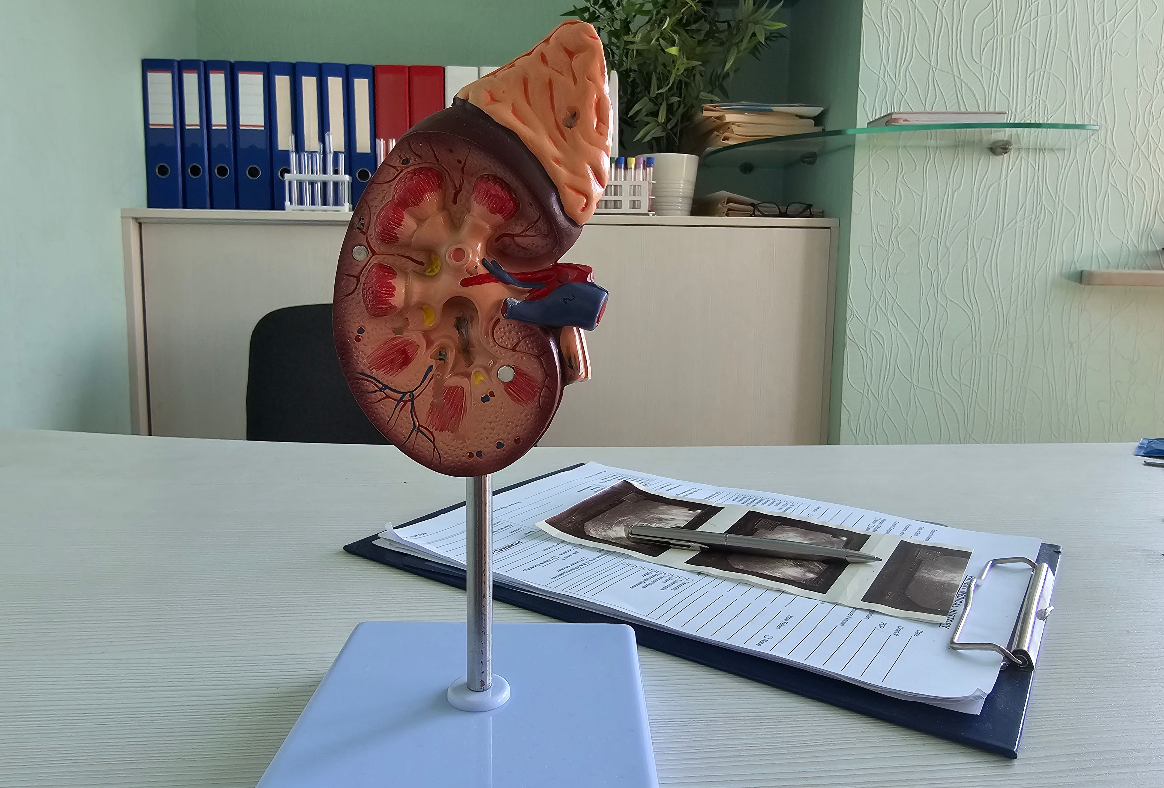 Muğla'da 4 cm böbrek taşı tek seansta temizlendi — Turizm
