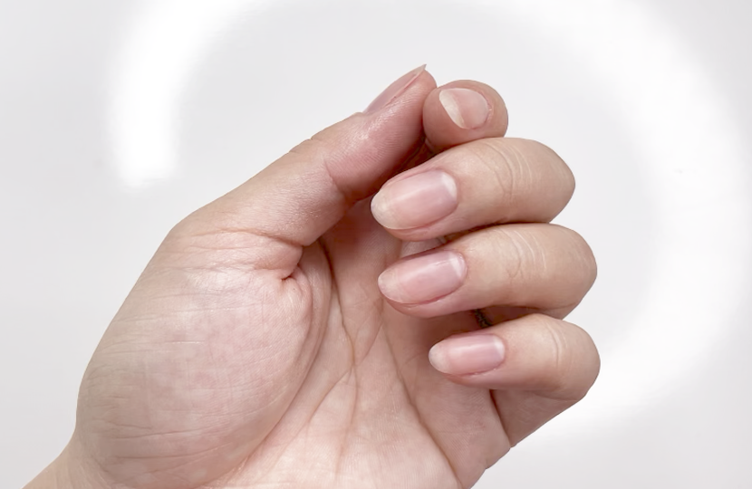 How to remove pesky hangnails