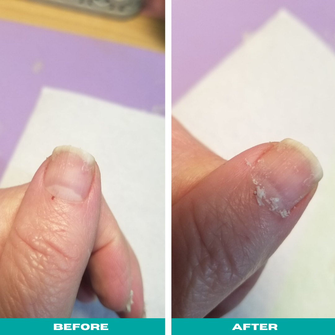 10,000+ Shoppers With “Paper-Thin” Nails Just Bought This $4 Strengthening  Treatment
