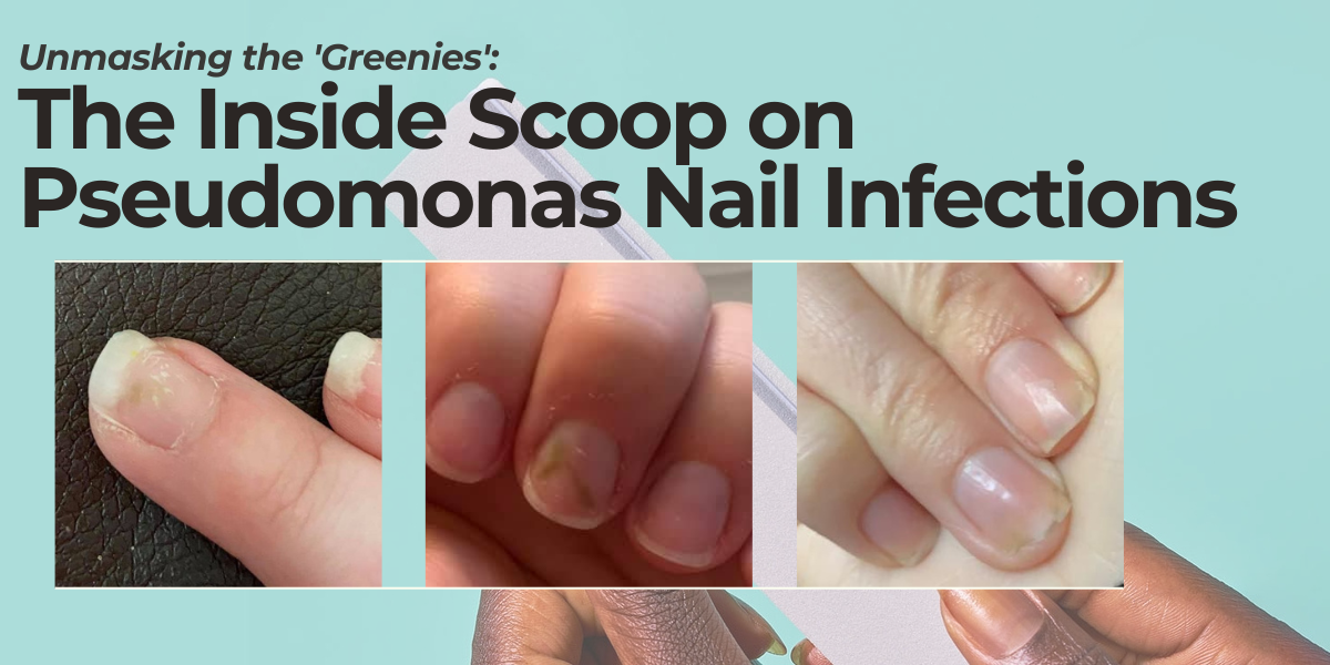 green nail syndrome