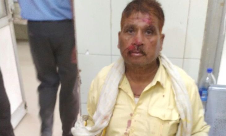 डबरा-दतिया मार्ग पर तेज रफ्तार एंबुलेंस की टक्कर से बाइक सवार वृद्ध गंभीर घायल