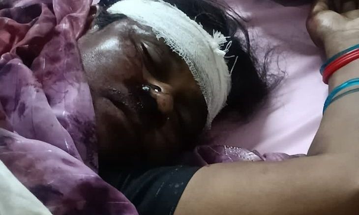 शिवपुरी: बेटी को हॉस्टल छोड़ने जा रही महिला की सड़क हादसे में दर्दनाक मौत