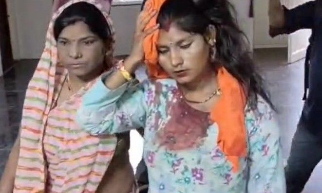 गुना की सपेरा बस्ती में खूनी संघर्ष, छेड़छाड़ और आपसी रंजिश के चलते भिड़े दो पक्ष