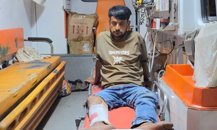 डबरा में घर के बाहर बैठे युवक पर लोहे के सरिए से जानलेवा हमला, पैर में फ्रैक्चर होने पर ग्वालियर रेफर
