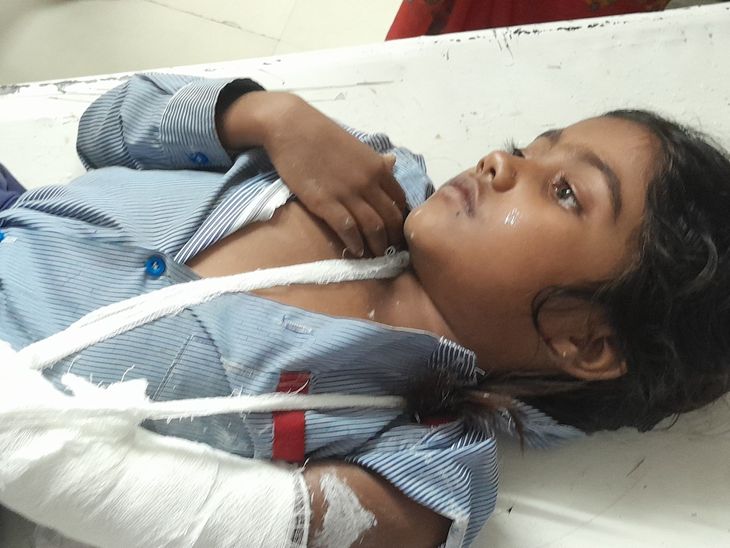 भिंड में क्षमता से अधिक स्कूली बच्चे ले जा रही वैन पलटी, नौ वर्षीय छात्रा का हाथ टूटा