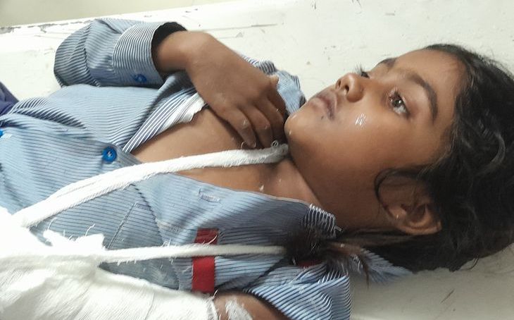 भिंड में क्षमता से अधिक स्कूली बच्चे ले जा रही वैन पलटी, नौ वर्षीय छात्रा का हाथ टूटा