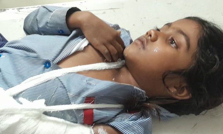 भिंड में क्षमता से अधिक स्कूली बच्चे ले जा रही वैन पलटी, नौ वर्षीय छात्रा का हाथ टूटा