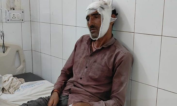 शिवपुरी: फॉरेस्ट नर्सरी में मवेशी चराने को लेकर खूनी संघर्ष, दोनों पक्षों पर क्रॉस केस दर्ज