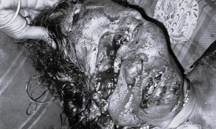 शिवपुरी के ठेह गांव में बुजुर्ग दंपती पर जानलेवा हमला, बीच-बचाव करने आई महिला के चेहरे पर किए चाकू से कई वार