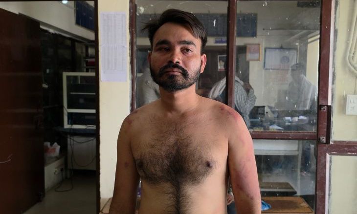 डबरा: टेकनपुर के युवक का अपहरण कर चीनौर में बेरहमी से पीटा, पुलिस जांच में जुटी