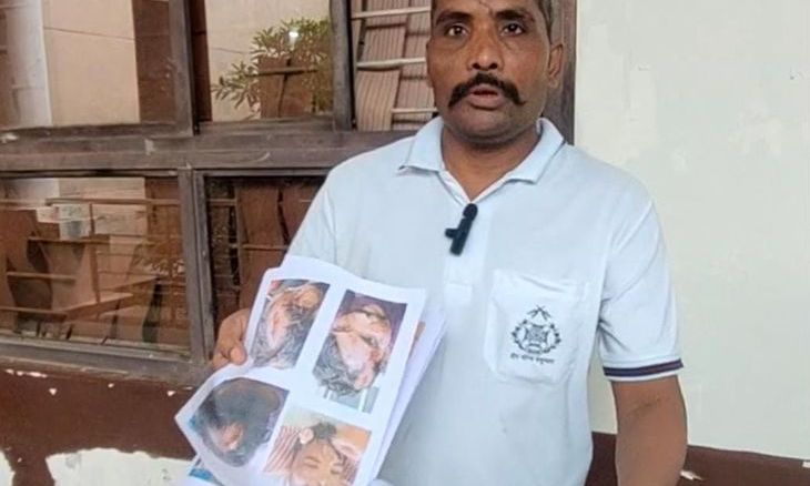 ग्वालियर: 1000 बिस्तर अस्पताल में डॉक्टर और गार्ड विवाद, मारपीट के बाद भी कार्रवाई न होने पर जनसुनवाई में पहुंचा पीड़ित