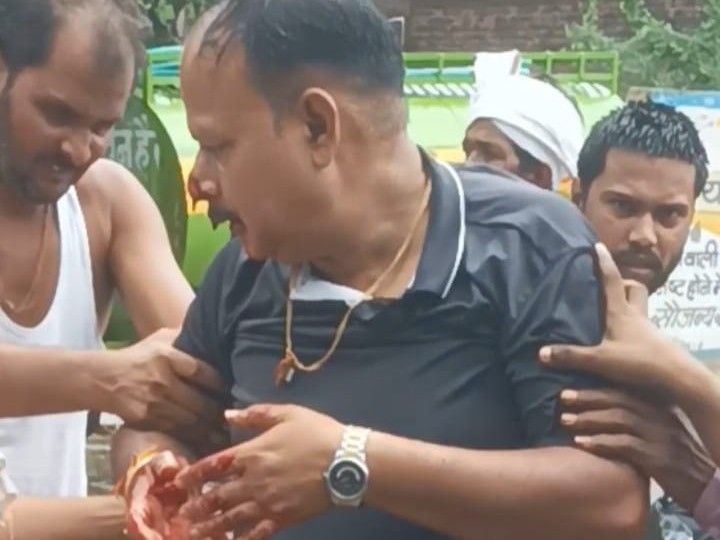 बाइक सहित खुले चेंबर में गिरे वार्ड 9 के पार्षद मनोज खजांची