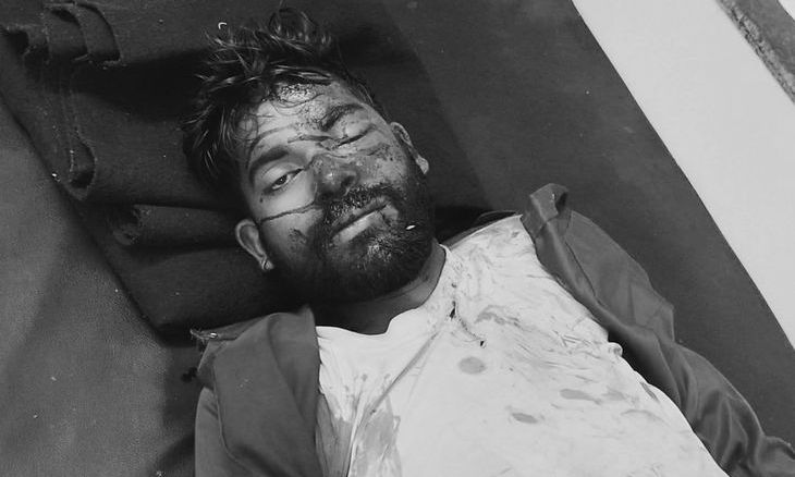 अशोकनगर में रफ्तार का कहर: पिपरई मार्ग पर भीषण बाइक भिड़ंत में एक की मौत, छह अन्य घायल