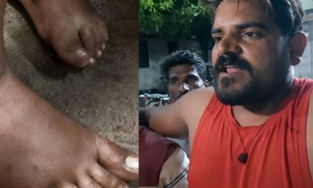 शिवपुरी में 50 लाख की चोरी का मामला: हिरासत से लौटे ट्रेनर ने पुलिस पर लगाए थर्ड डिग्री टॉर्चर के आरोप