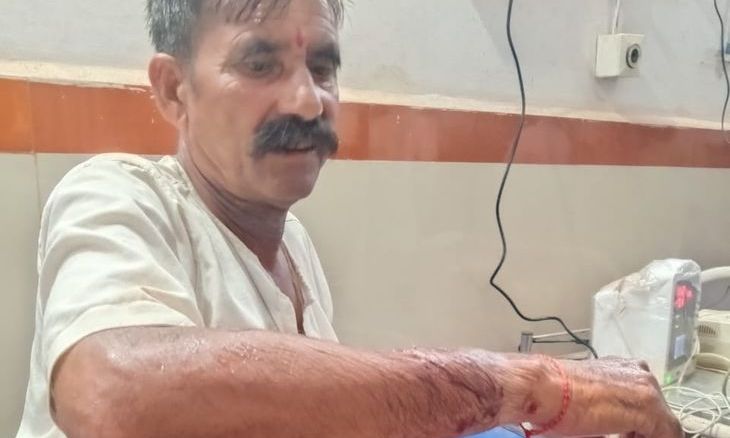शिवपुरी में नाती की रक्षा के लिए सियार से भिड़े बुजुर्ग, बेटे ने लाठी से किया ढेर
