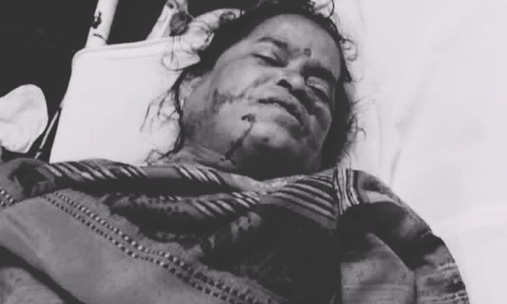 मुरैना की महिला को शिवपुरी में सांप ने डसा, मेडिकल कॉलेज में इलाज के दौरान मौत