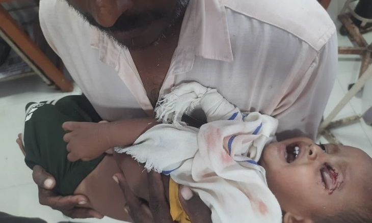 मुरैना: डेढ़ वर्षीय मासूम पर आवारा कुत्ते का हमला, आंख पर गंभीर चोट