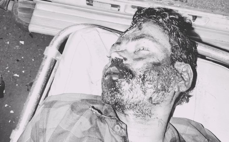 शिवपुरी में सड़क हादसा: लुकवासा फोरलेन पर अज्ञात वाहन की टक्कर से बाइक सवार युवक की मौत