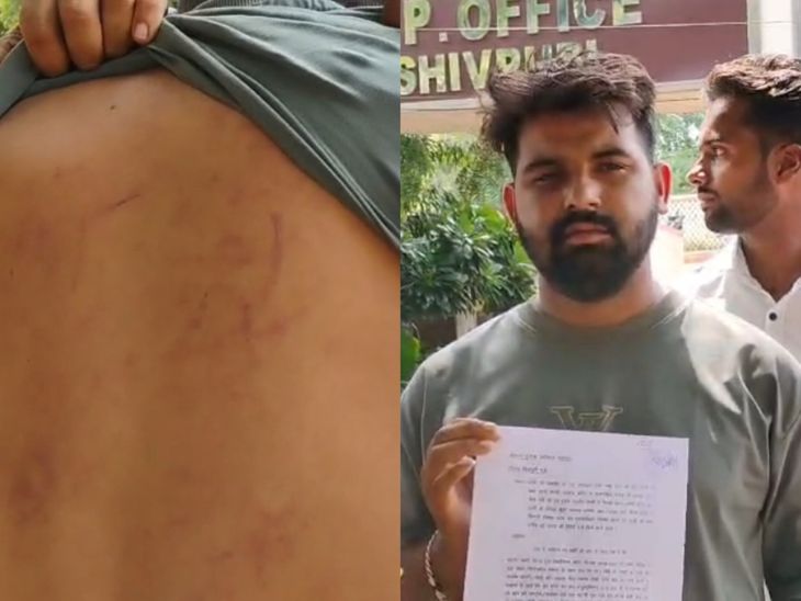 शिवपुरी के सिल्लारपुर में राशन वितरण पर बवाल: युवक ने सरपंच और सेल्समैन पर लगाया मारपीट का गंभीर आरोप