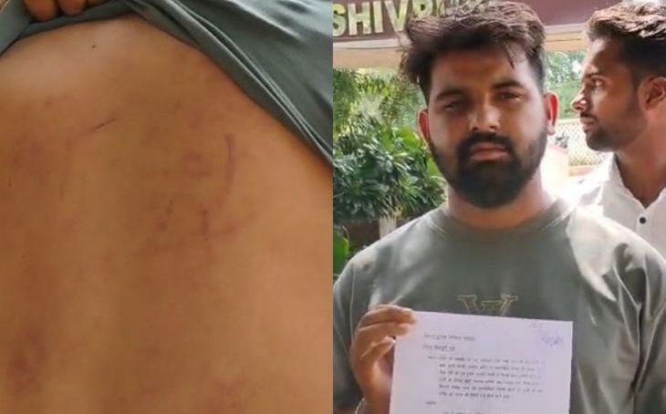 शिवपुरी के सिल्लारपुर में राशन वितरण पर बवाल: युवक ने सरपंच और सेल्समैन पर लगाया मारपीट का गंभीर आरोप