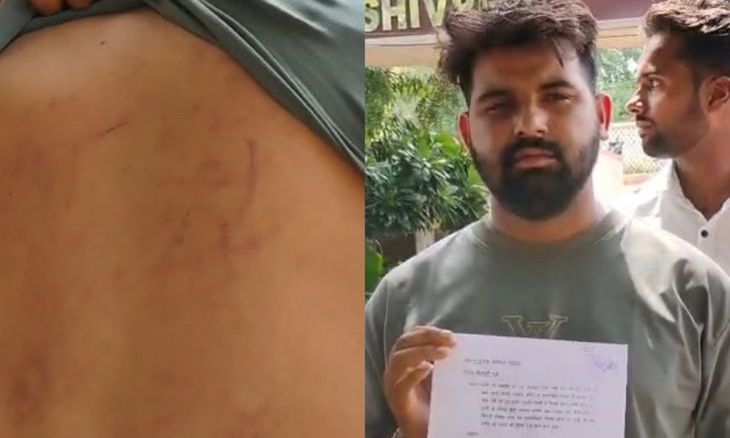 शिवपुरी के सिल्लारपुर में राशन वितरण पर बवाल: युवक ने सरपंच और सेल्समैन पर लगाया मारपीट का गंभीर आरोप