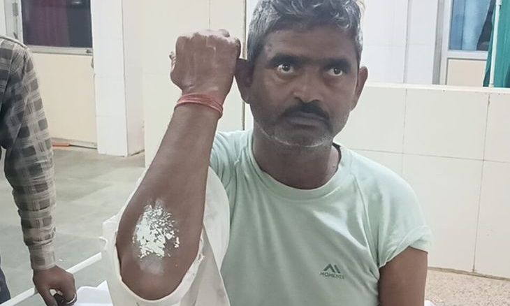अंबाह क्षेत्र में जंगली सियार का आतंक: घर के बाहर बैठे पूर्व सरपंच पर हमला कर किया घायल