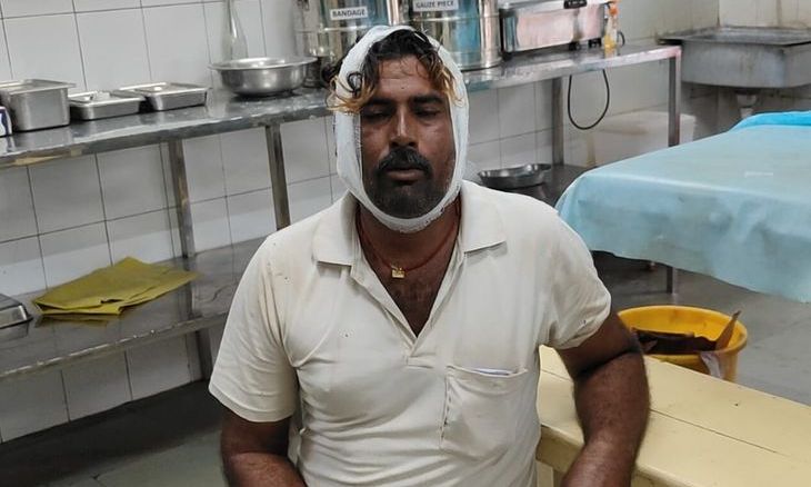 शिवपुरी में जमीन के पुराने बंटवारे पर खूनी संघर्ष, छोटे भाई ने बड़े भाई पर लाठियों से बोला हमला