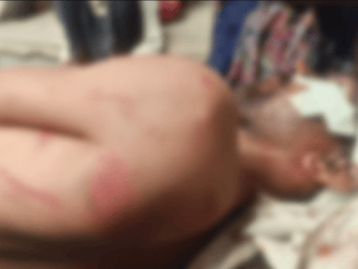 अशोकनगर में गाली-गलौज का विरोध करने पर खूनी संघर्ष, कुल्हाड़ी और डंडों से हमला कर तीन को किया घायल