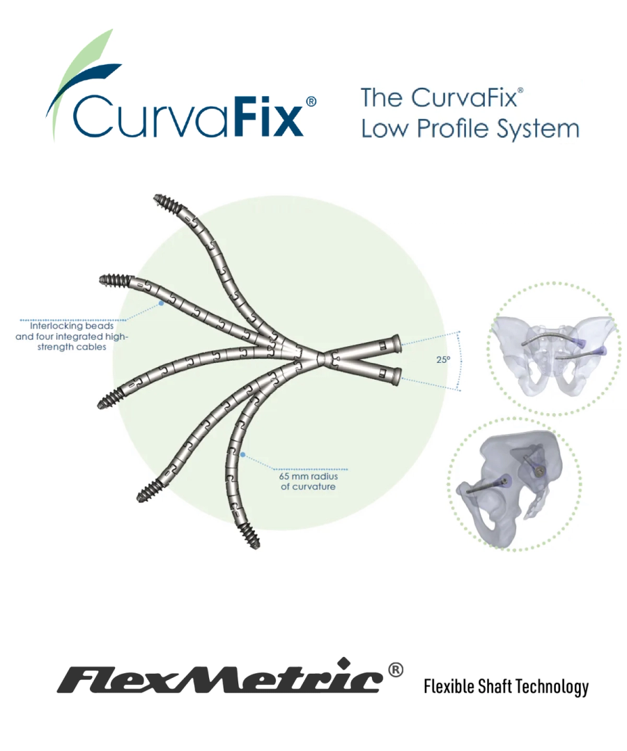 Close-up of a FlexMetric flexible shaft showing the slice-cut architecture