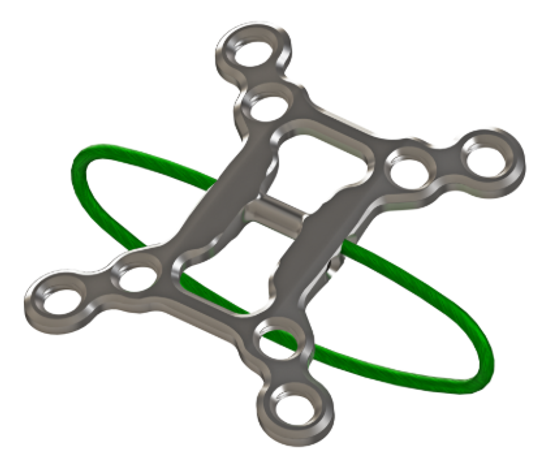 Sternal Closure Plate System