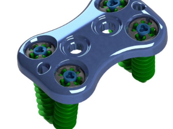 Anterior Lumbar Plate System