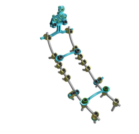 Pedicle Screw and Rod Systems