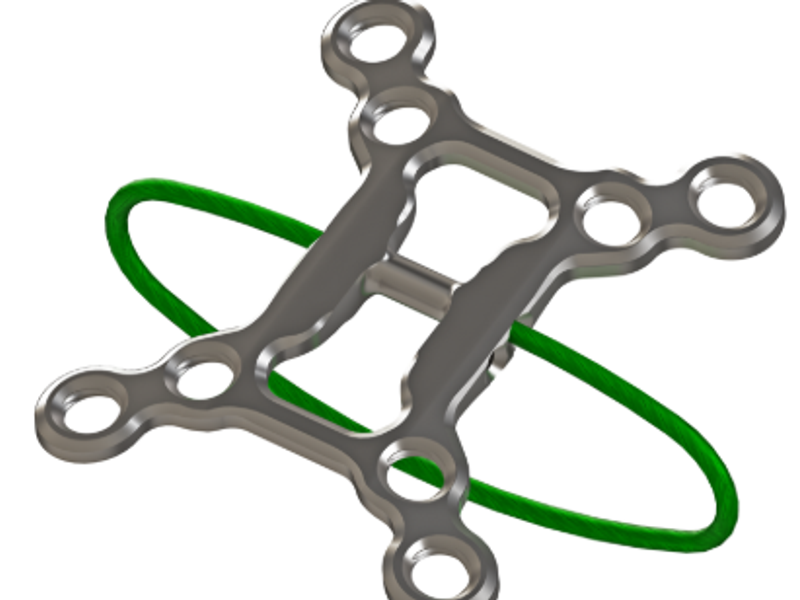 Sternal Closure Plate System