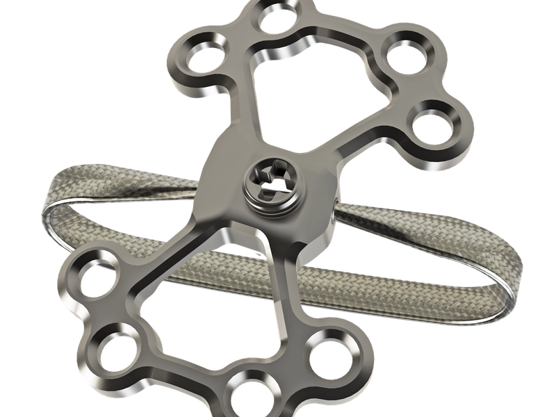 Advanced Sternal Closure Plate System