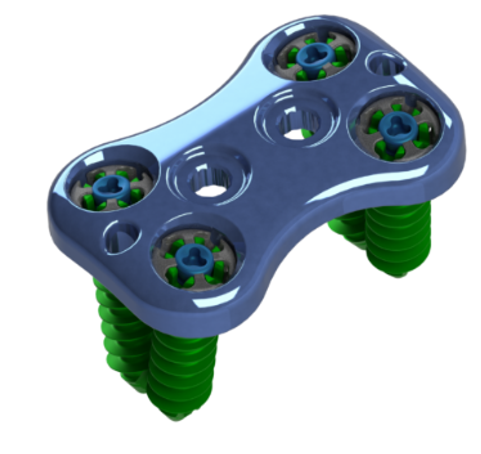 Anterior Lumbar Plate System