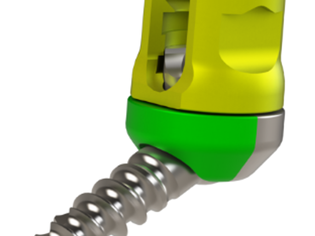 High Angle CT Screw System