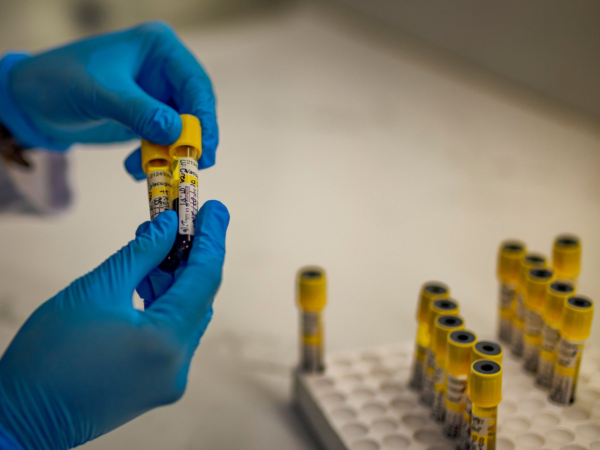 Global AIDS Response Faces Critical Threat Amid Funding Cuts, Jeopardizing a Generation