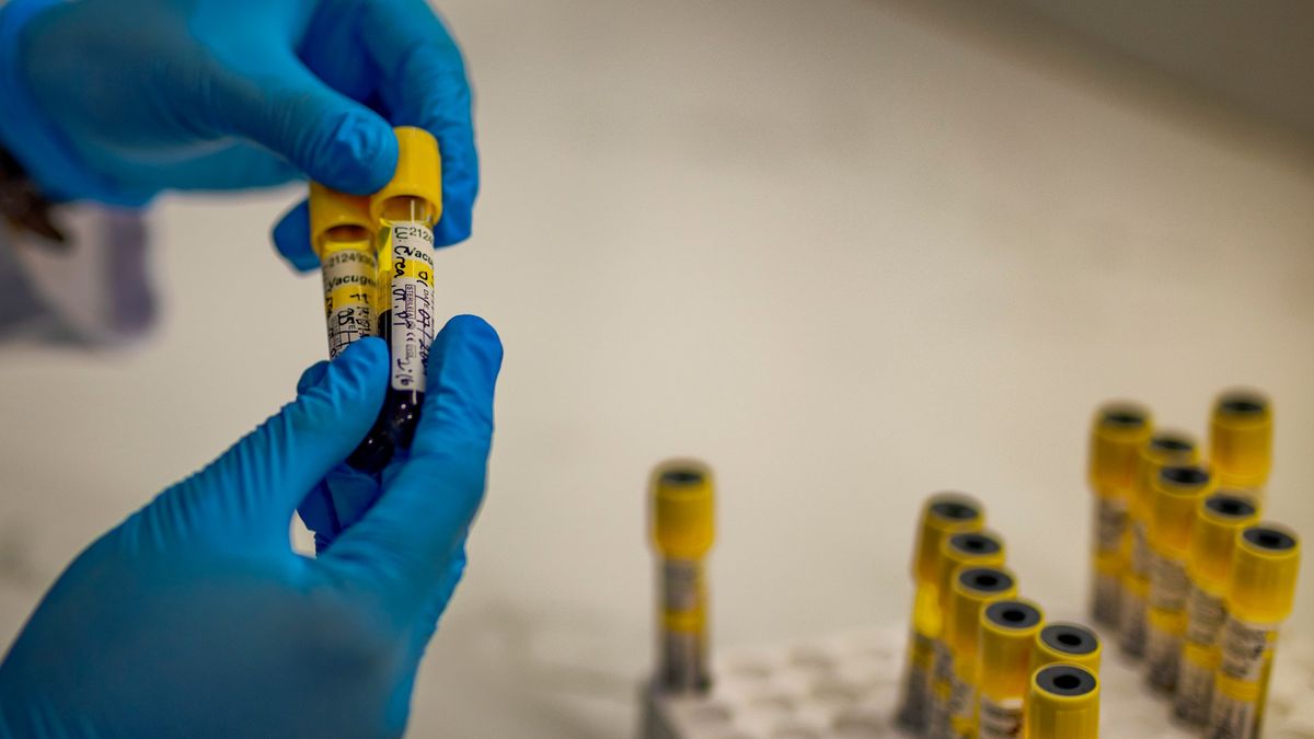 Global AIDS Response Faces Critical Threat Amid Funding Cuts, Jeopardizing a Generation