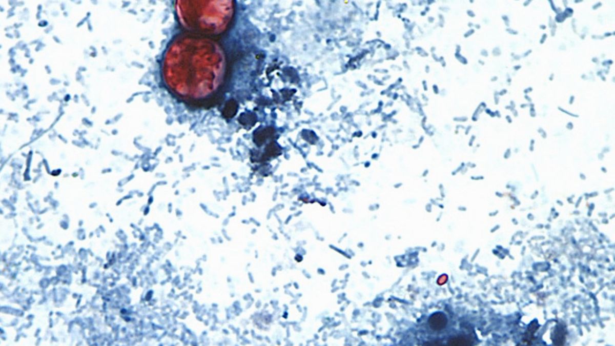 The Unseen Toll of a Parasite: Behind the US Cyclospora Outbreak