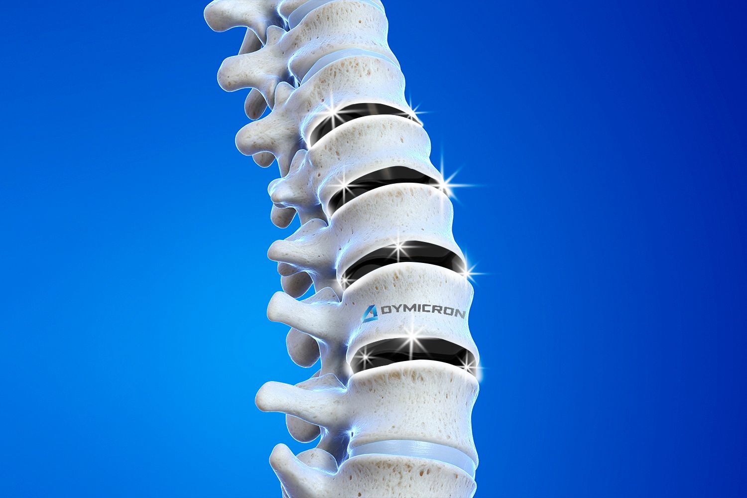 This company discovered a diamond (disc) in the rough