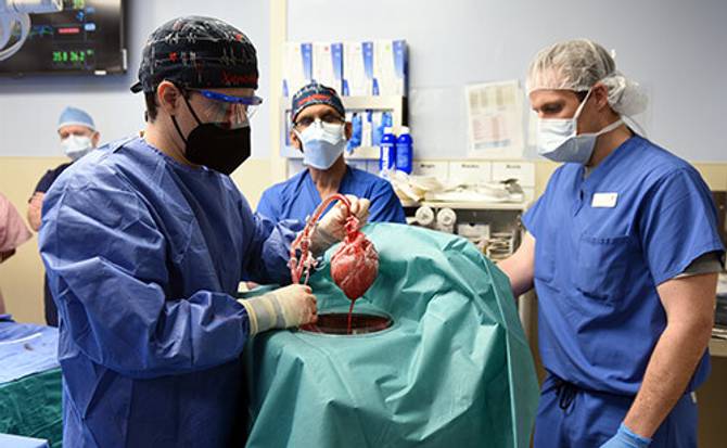 Surgeons holding a heart above a covered patient 