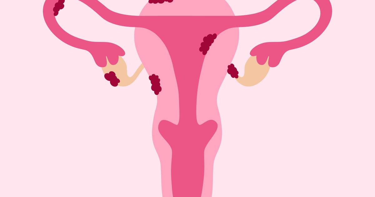GE HealthCare sets sights on imaging for women’s health GE HealthCare sets sights on imaging for women’s health