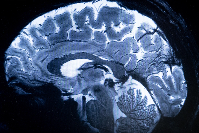 This image made with the Iseult Magneton 11.7 T MRI shows a brain during a magnetic resonance imaging (MRI) exam simulation at the Neurospin facilities in the Paris-Saclay Alternative Energies and Atomic Energy Commission.