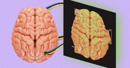 A 3D human brain connected by wires to a screen displaying another human brain 