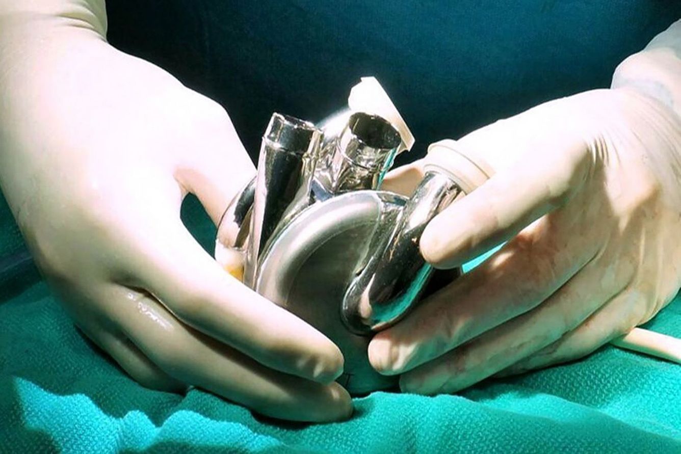 Surgeon holding an artificial heart.