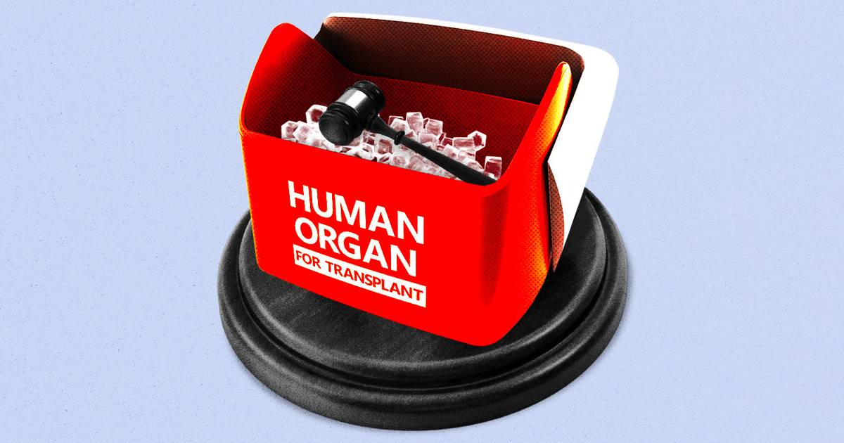 CMS’s kidney transplant overhaul has begun CMS’s kidney transplant overhaul has begun