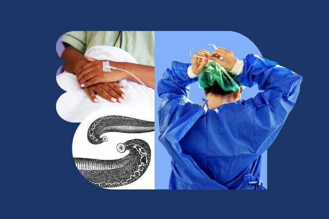 A photo composite of rear view of a surgeon wearing sterile clothes, a patient with an IV in hand and leeches. Photos: Getty Images