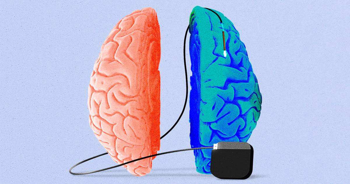 Are we entering a neurotechnology renaissance in healthcare? Are we entering a neurotechnology renaissance in healthcare?