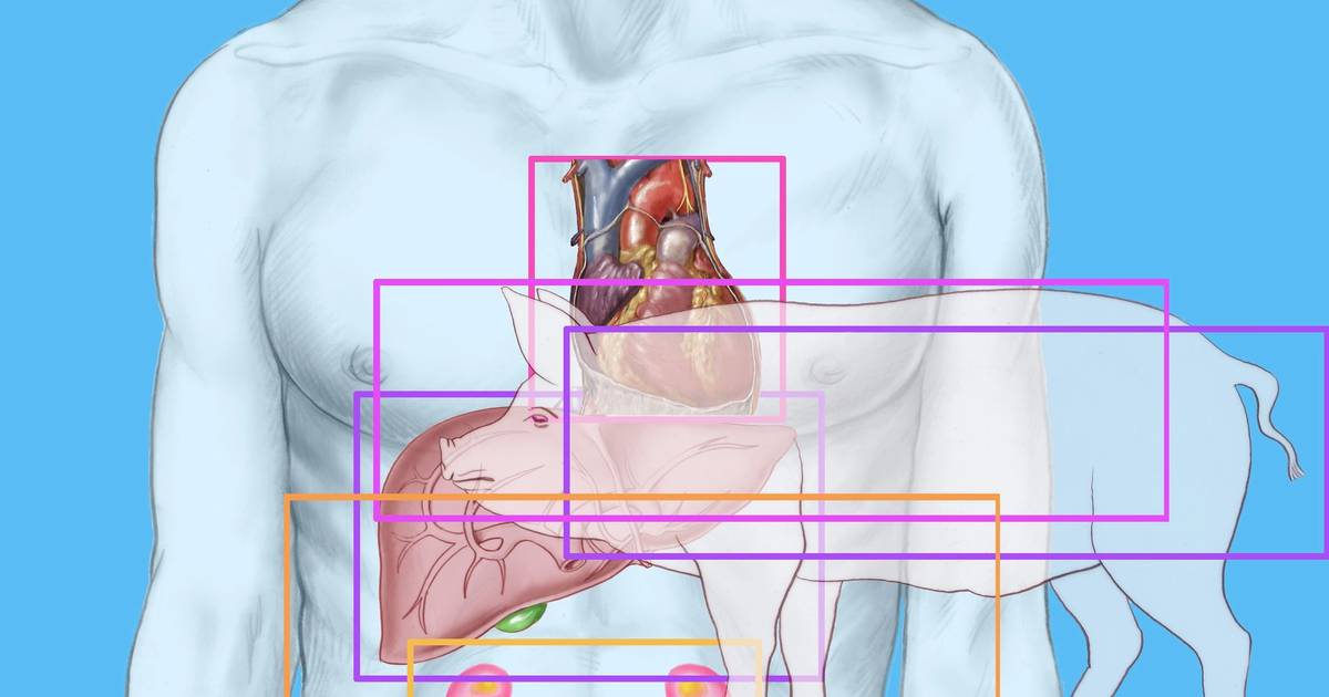 Hope remains strong following pig kidney transplant patient’s death Hope remains strong following pig kidney transplant patient’s death
