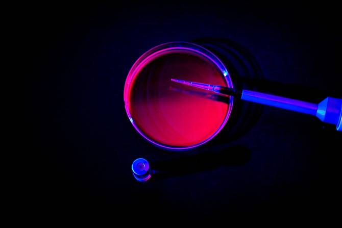 image of a pipette resting on a petri dish